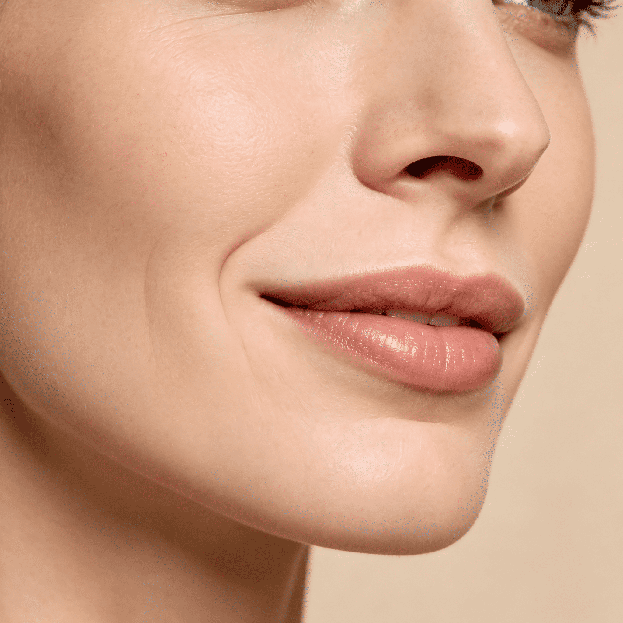 Nasolabial Folds