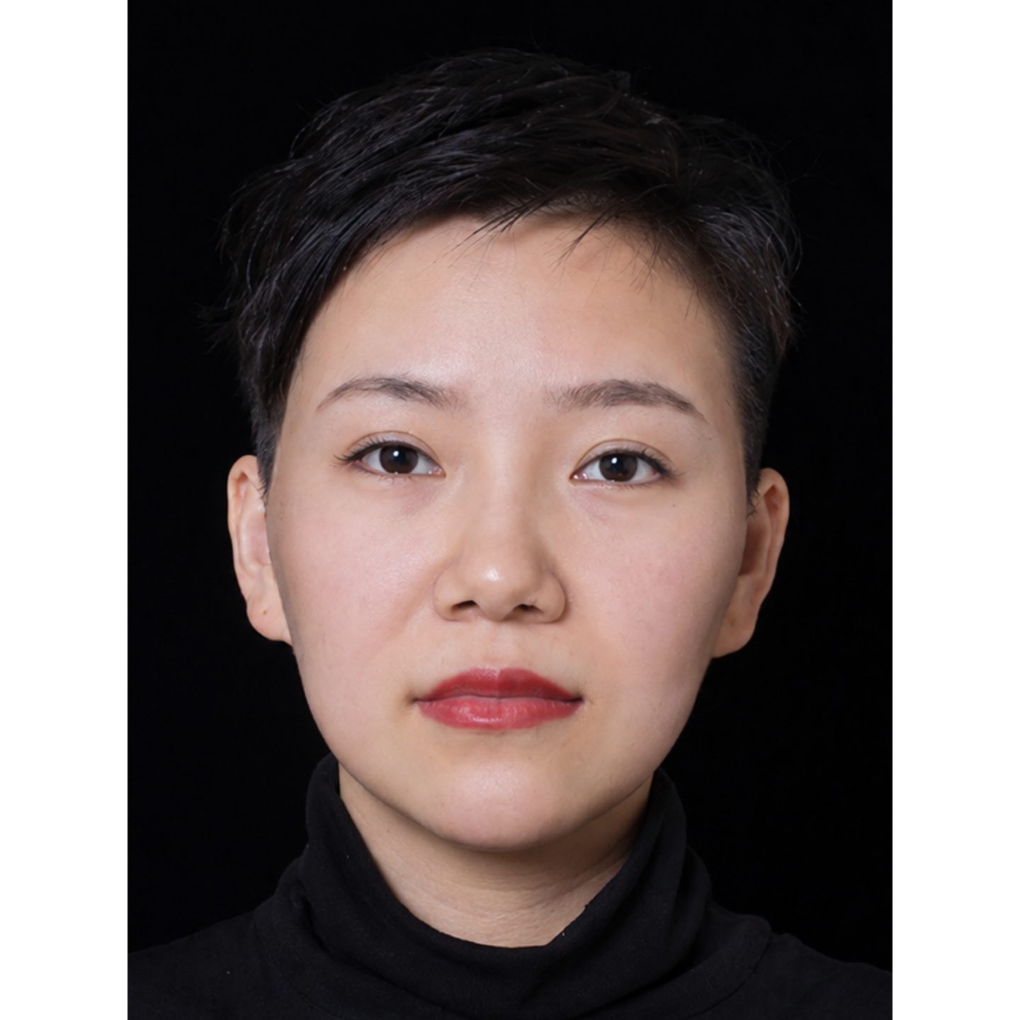 Before — Beatrice Dermdeep clinical case: full face