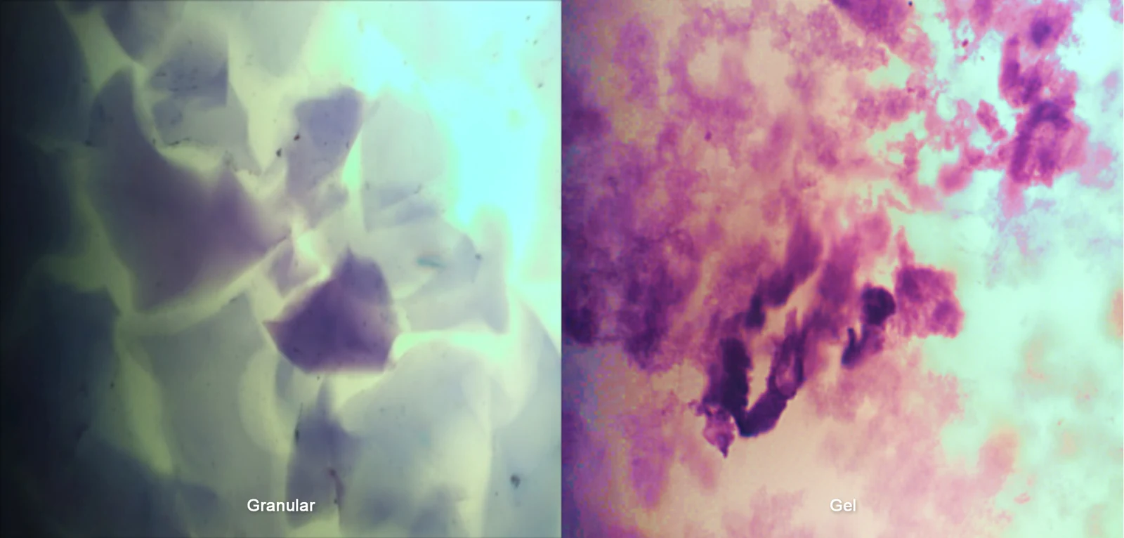 Microscopy comparison showing a homogeneous single-phase hyaluronic acid gel structure